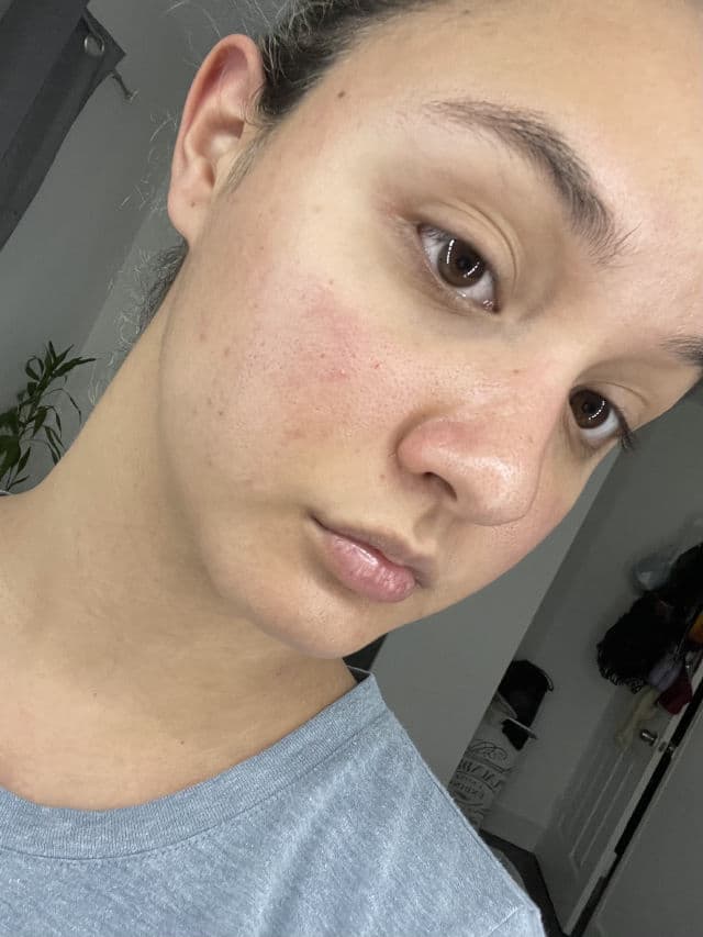 ELIZAVECCA Hell Pore Clean Up AHA Fruit Toner review photo by SophiaDelarosa