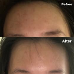 SKIN1004 [Discontinued] Madagascar Centella Asiatica 100 Ampoule (100ml) review photo by Stevanie