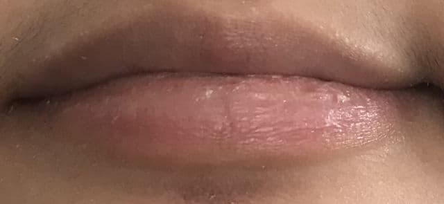 Blistex Lip Medex® review photo by Sydney