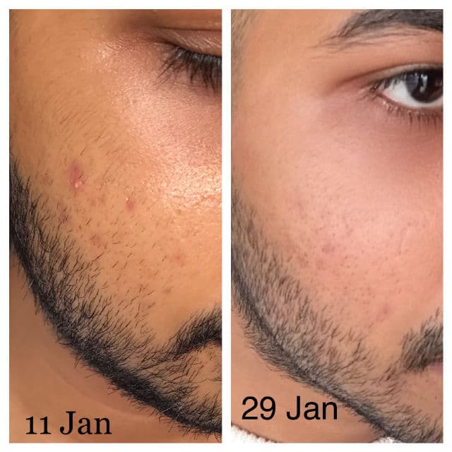 GOODAL Green Tangerine Vita C Dark Spot Care Serum review photo by TAABS