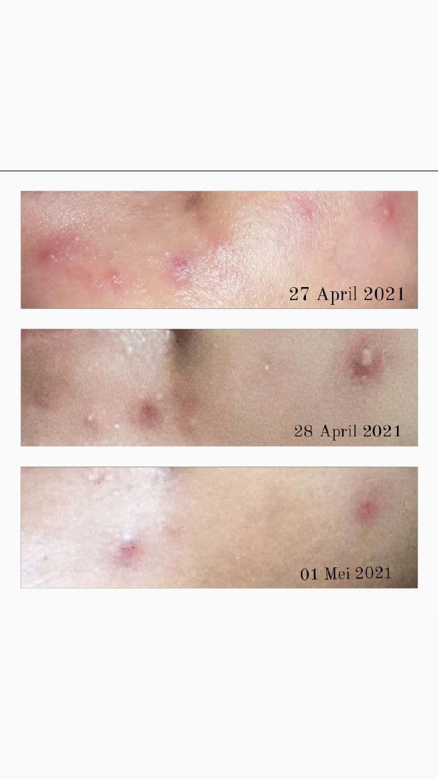 Noola Breezy Willow Moist Serum review photo by Tamekari
