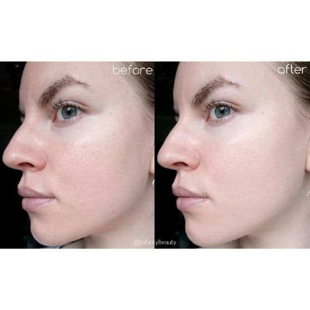 Some By Mi Super Matcha Pore Tightening Serum review photo by TanyaKbeauty