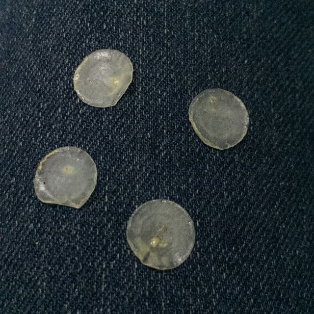 By WISHTREND Clear Skin Shield Patch review photo by TheGeekyBeaute