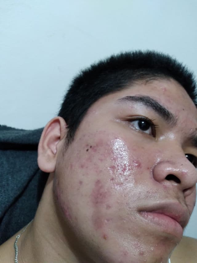 Garnier Light Complete Vitamin C Booster Serum review photo by Tolits