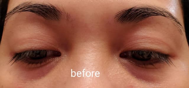 KORA Organics Berry Bright Vitamin C Eye Cream review photo by Twapslove