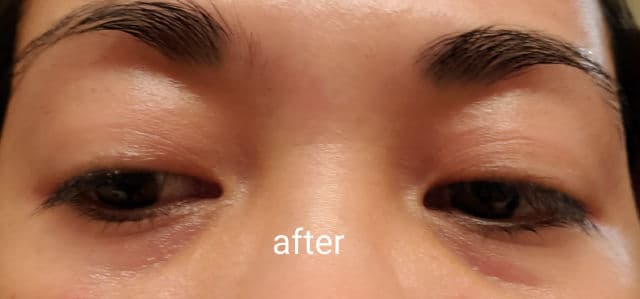 KORA Organics Berry Bright Vitamin C Eye Cream review photo by Twapslove
