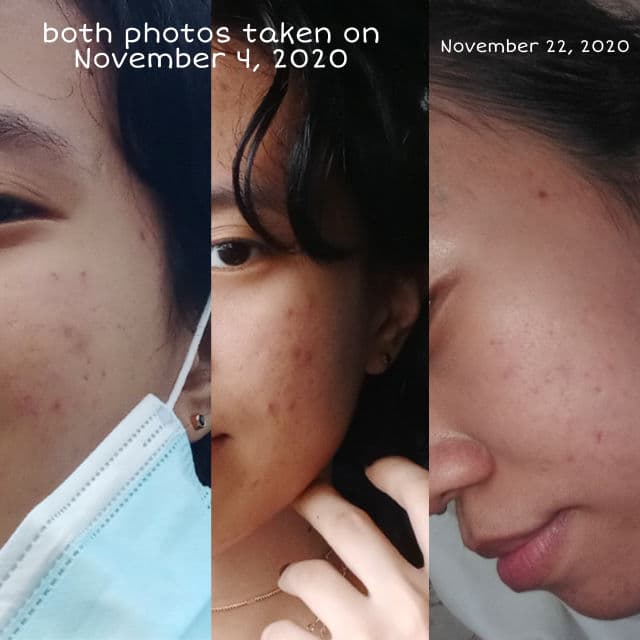 Breylee Vitamin C Serum review photo by Zenister