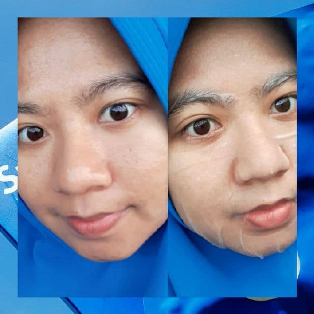 VT COSMETICS Super Hyalon Mask review photo by Ziyah