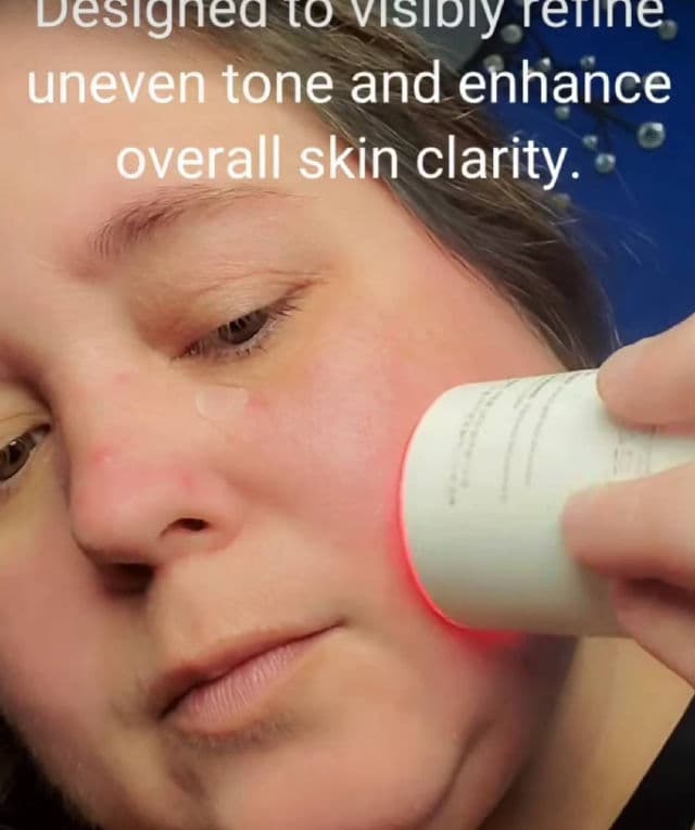 Meditherapy Arbutin Skin Booster Serum + Device review photo by DawnsReviews
