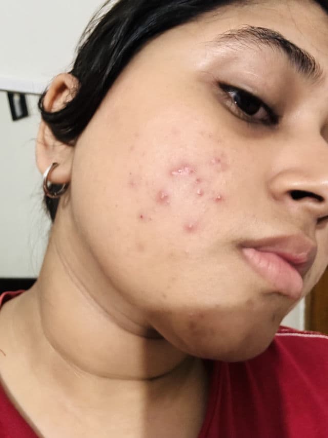 SKIN1004 Madagascar Centella Ampoule Kit review photo by Venus97