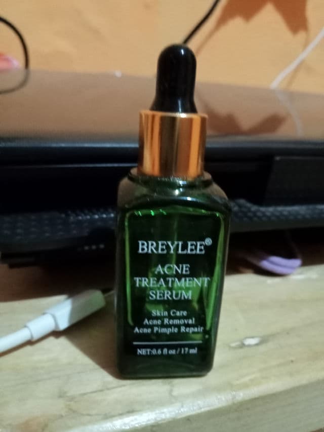 Breylee Acne Treatment Serum review photo by adilkizi