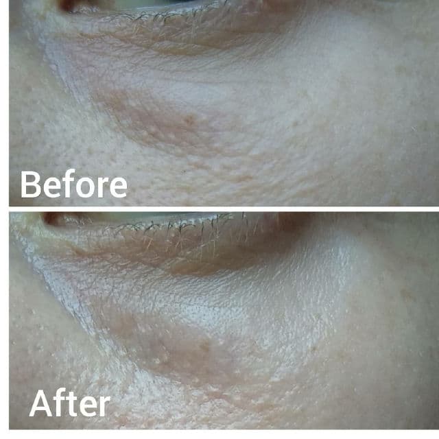 Generation Skin Hydrating Marine Algae Eye Patches review photo by alexandraskrupnikova