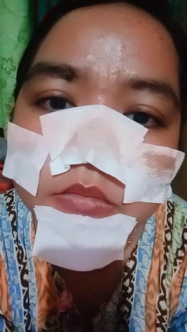 Breylee Blackhead Mask Serum - Step 1 review photo by ameliaoktarija