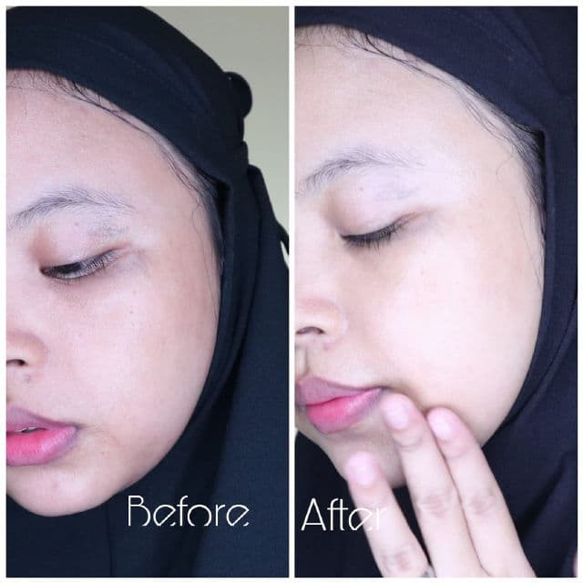 Wellage Real Hyaluronic Concentrate Ampoule review photo by anandadppl