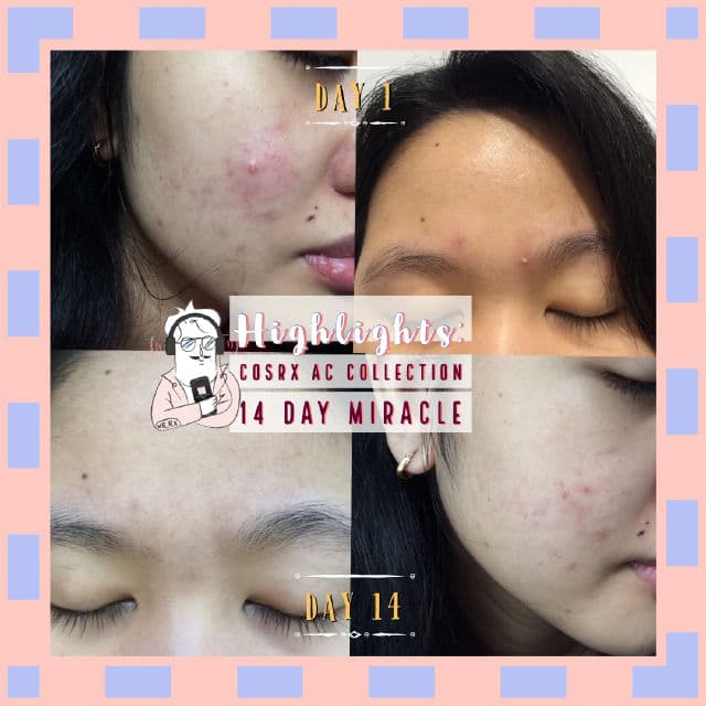COSRX AC Collection Calming Foam Cleanser review photo by angegege