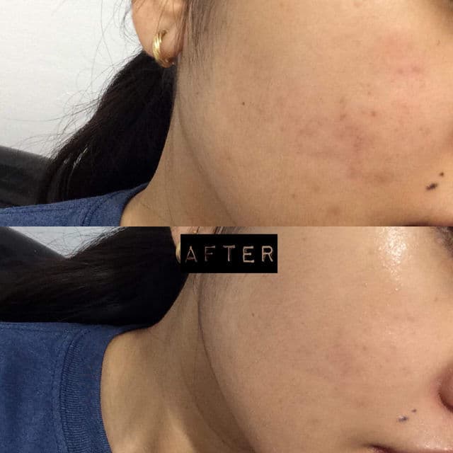 iWhite Korea Beige review photo by angegege