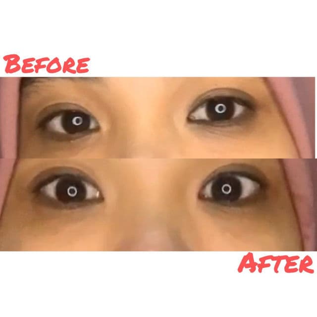 Mary Kay Hydrogel Eye Patches review photo by anissha