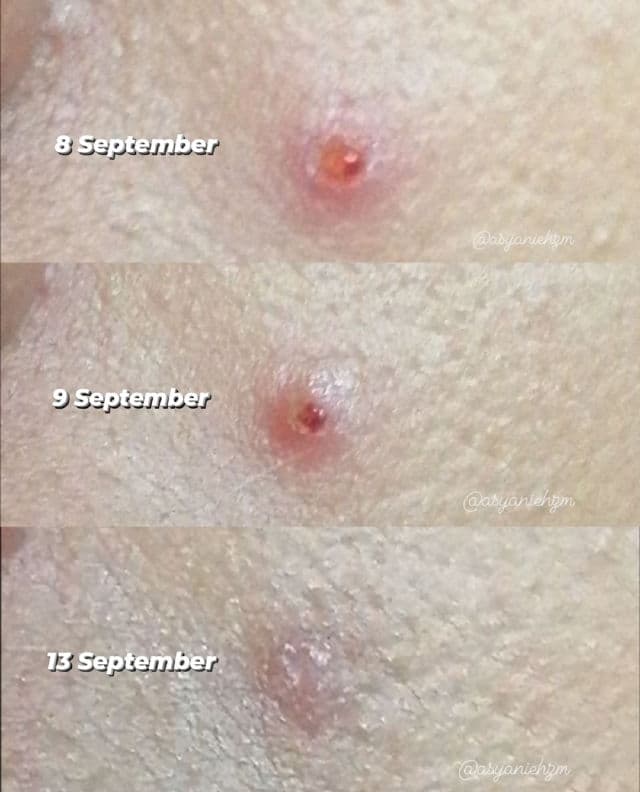 Madagascar Centella Ampoule product review
