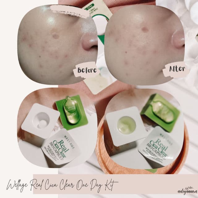 Wellage Real Cica Clear One Day Kit review photo by auliyaaaara