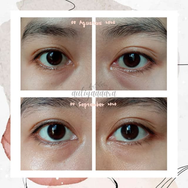 Lacoco en nature Intensive Treatment Eye Serum review photo by auliyaaaara