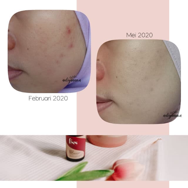 For Skin's Sake Retinol Overnight Cream review photo by auliyaaaara