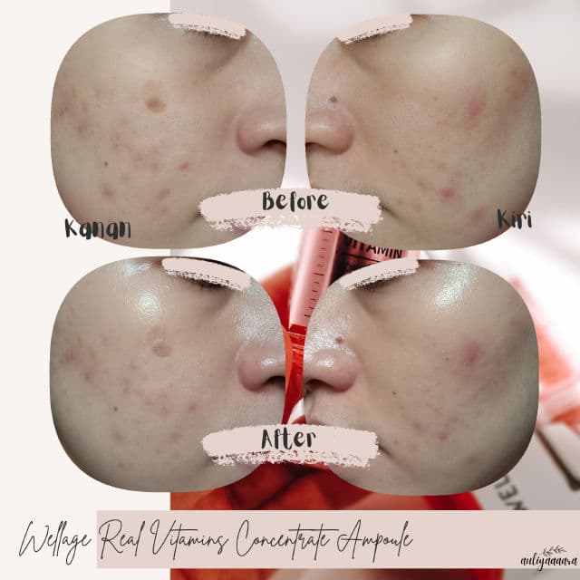 Wellage Real Vitamins Concentrate Ampoule review photo by auliyaaaara