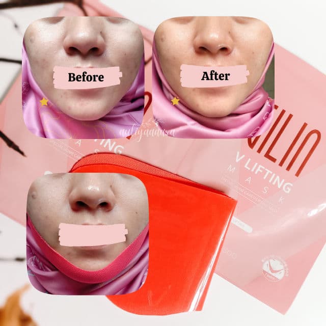 BELLASOO Gilin V Lifting Mask review photo by auliyaaaara