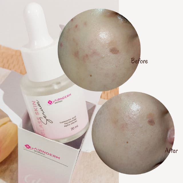 Airnderm Aesthetic Glass Skin Serum review photo by auliyaaaara