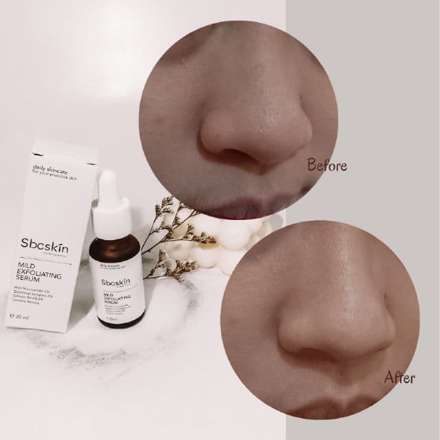 Sbcskin Mild Exfoliating Serum review photo by auliyaaaara