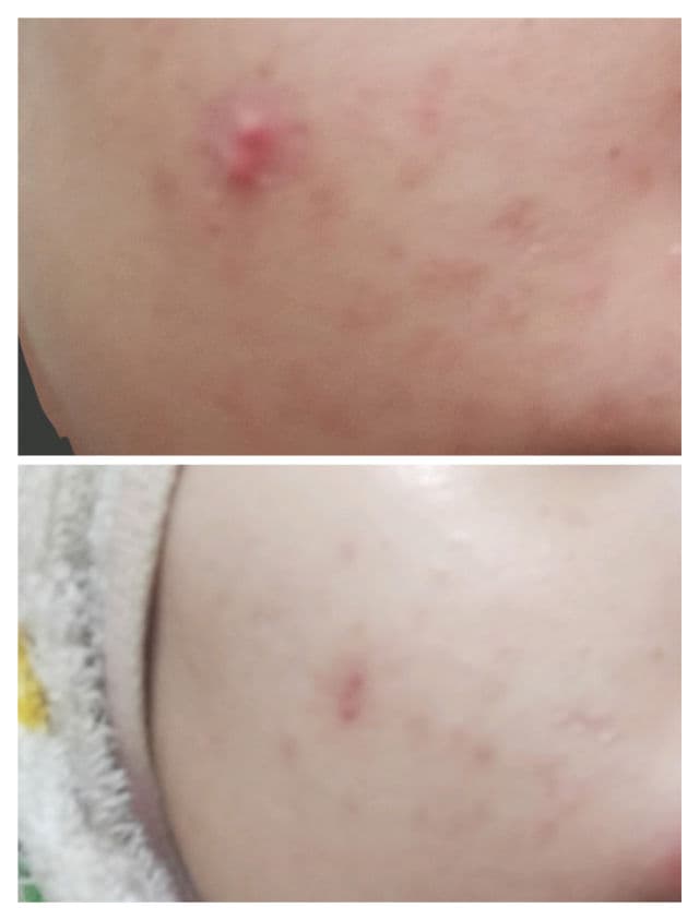 Alluskin Purifying Cleanser review photo by aurora00