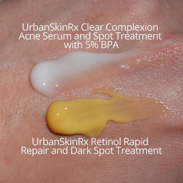 Urban Skin Rx Clear Complexion Acne Serum + Spot Treatment review photo by beautyerudite