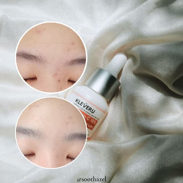 Kleveru Vitamin C 10% Ferulic Serum review photo by caramels