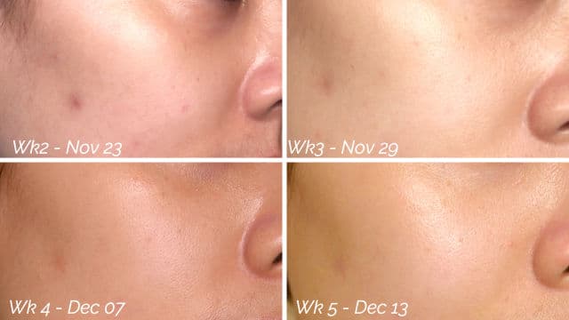 AXIS-Y Artichoke Intensive Skin Barrier Ampoule review photo by carrotstickbeauty
