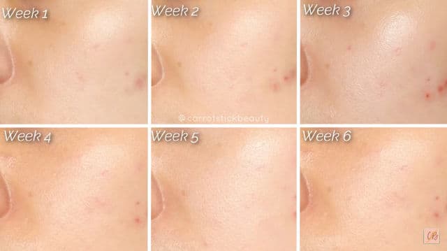 Ellana Cosmetics Glass-C Skin Brightening Serum review photo by carrotstickbeauty