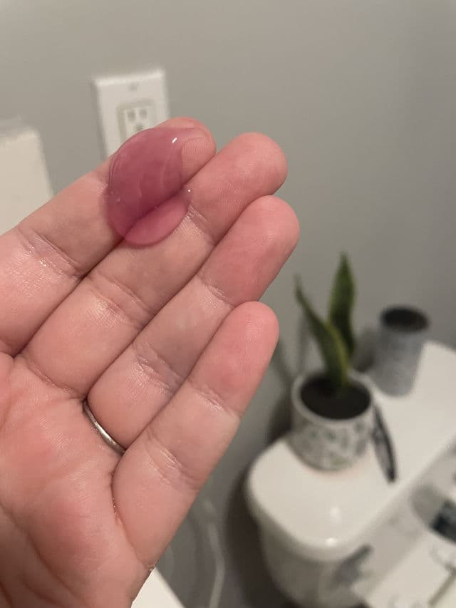 Biossance Squalane + Elderberry Jelly Cleanser review photo by Psoriaskin