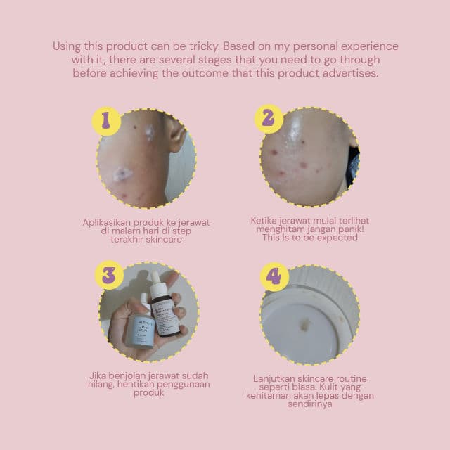 Bloomka TGIF Acne Spot Treatment review photo by chemicalconscious