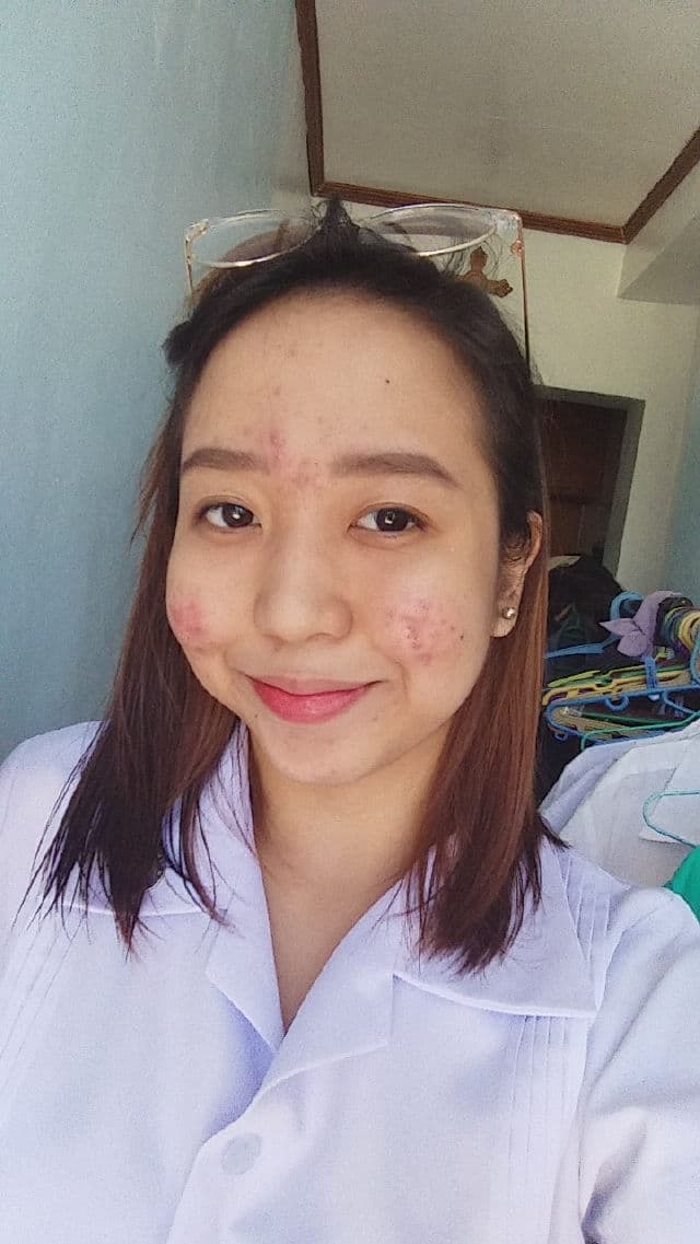 COSRX Salicylic Acid Daily Gentle Cleanser review photo by chingu