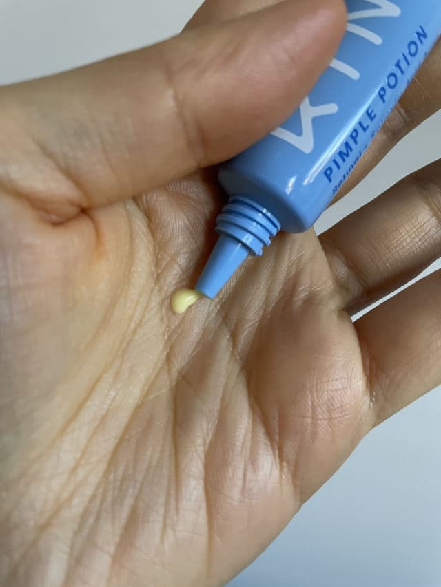 Kinship Pimple Potion review photo by christinesskin