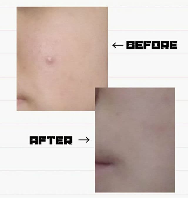 AXIS-Y Dark Spot Correcting Glow Serum review photo by bookieskin