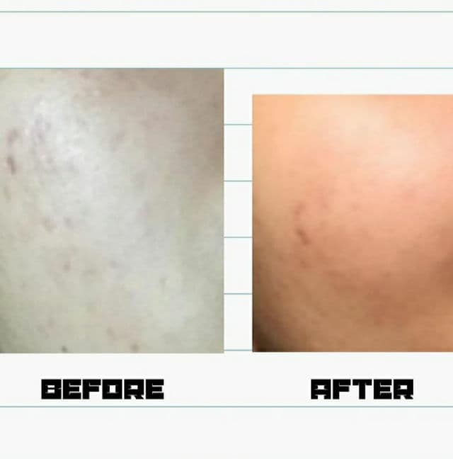 AXIS-Y Dark Spot Correcting Glow Serum review photo by bookieskin