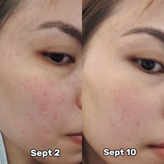 make p:rem Safe Me. Relief Watery Ampoule review photo by clarissaguzmann