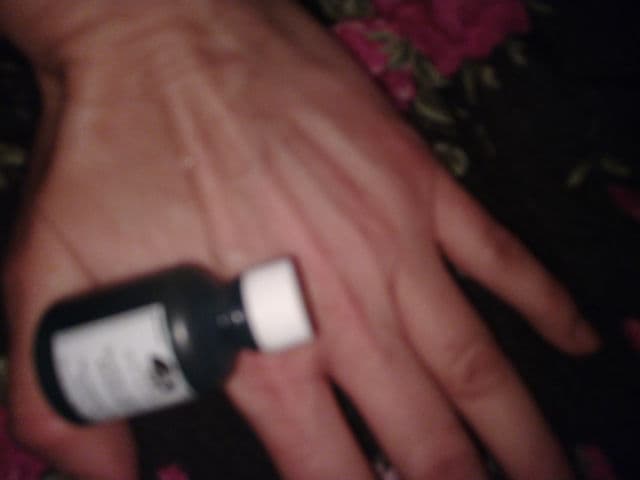 Origins Super Spot Remover, Acne Treatment Gel review photo by crimsonxerox