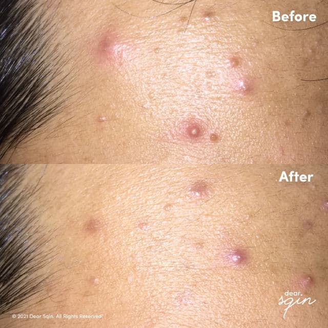 Rovectin Skin Essentials Cica Care Balm 40ml review photo by dearsqin