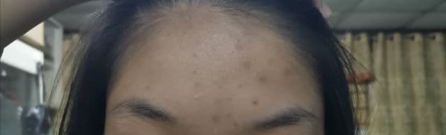 Fresh Formula Blemish Doctor Anti-Acne Facial Toner review photo by reviewsbynor
