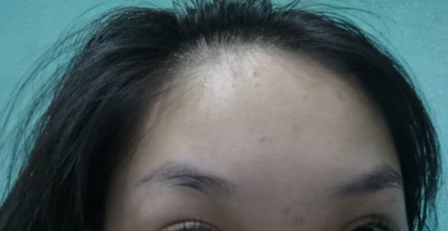 Luxe Organix Miracle Toner AHA/BHA Pore Clarifying Treatment review photo by reviewsbynor