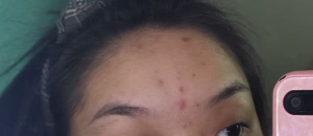 Luxe Organix Miracle Toner AHA/BHA Pore Clarifying Treatment review photo by reviewsbynor