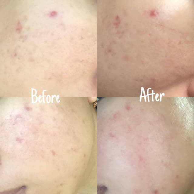 Pratista Retinoid Night Cream review photo by ditaputri