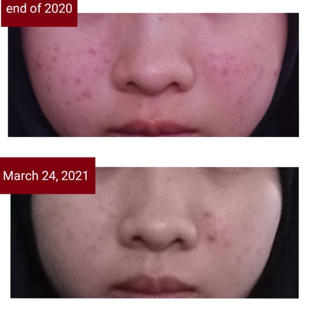 Somethinc 10% Niacinamide + Moisture Sabi Beet Serum review photo by djeedj
