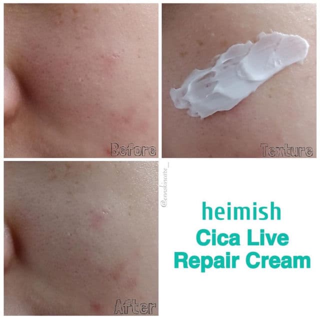 Heimish Cica Live Repair Cream review photo by ennskincare