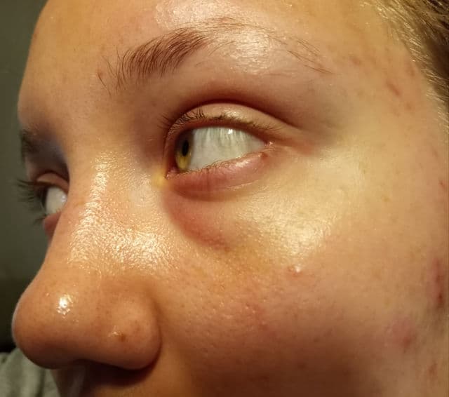Earth to Skin Super Fruits Banana Brightening Eye Cream review photo by ericherry